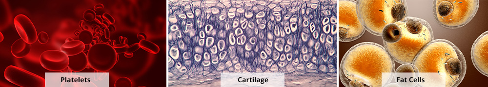 cartilage platelets fat