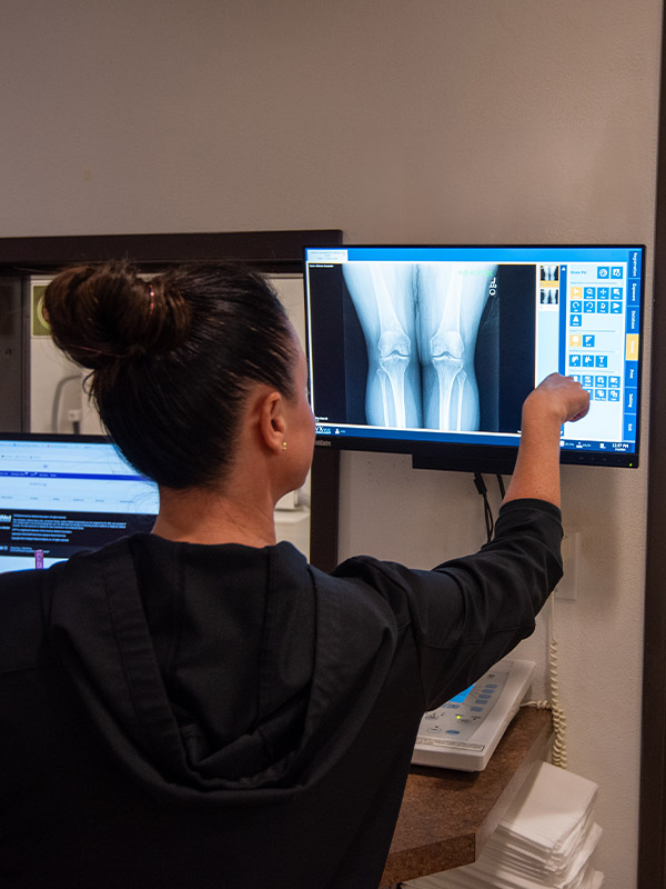 knee X-ray